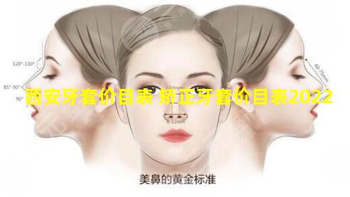 西安牙套价目表 矫正牙套价目表2022
